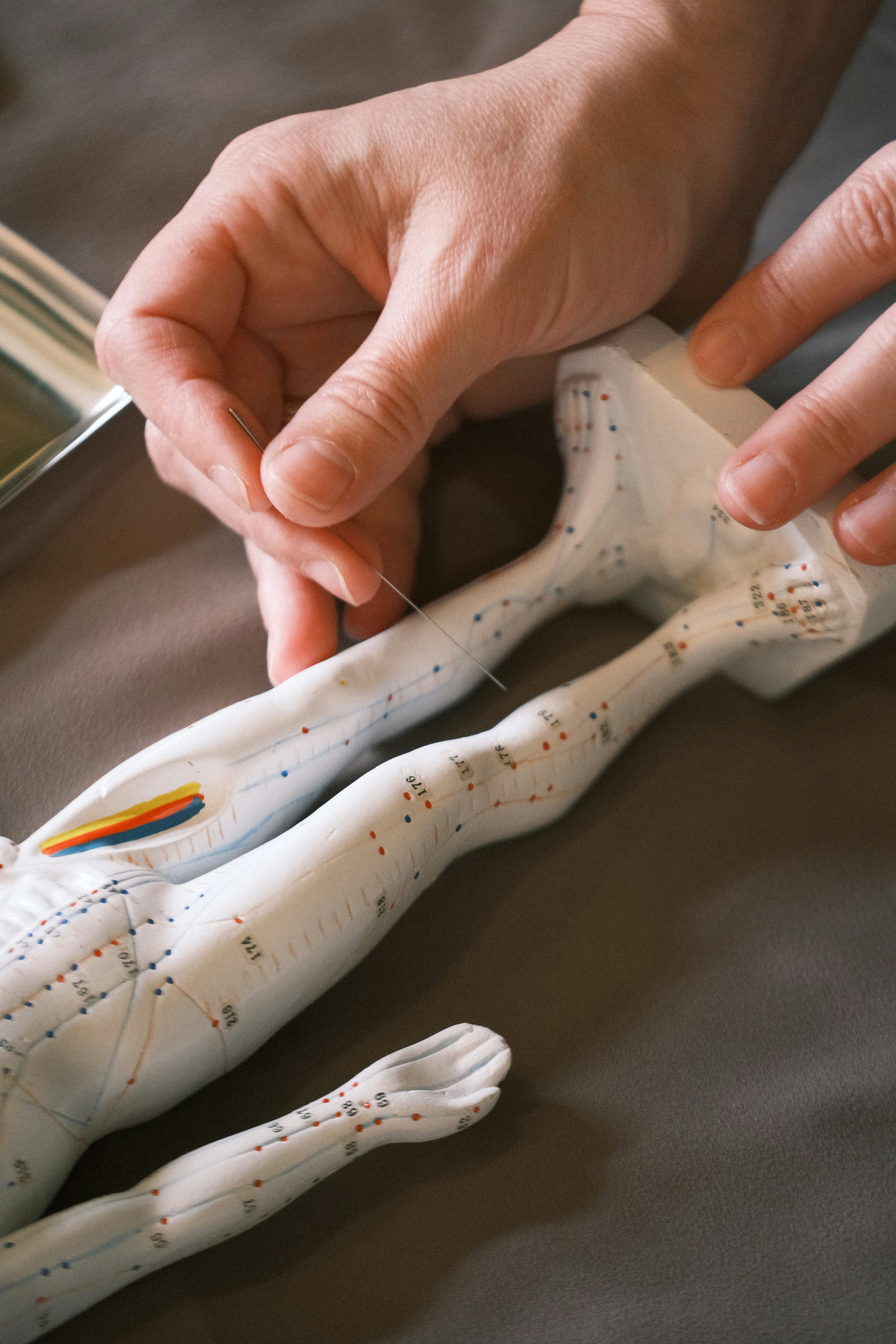 Hand inserting a fine needle into an acupuncture anatomy model — dry needling demonstration